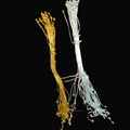 Fuse wire / ball pins || golden and silver colour || 10 grams - 100grams pack || raw materials ||